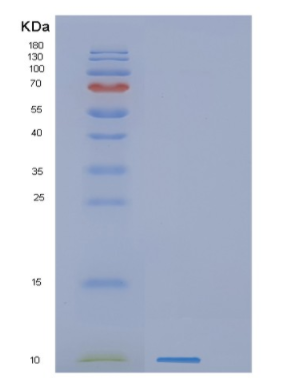 Recombinant Human GNG11 Protein,Recombinant Human GNG11 Protein