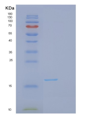 Recombinant Human GPC4 Protein,Recombinant Human GPC4 Protein