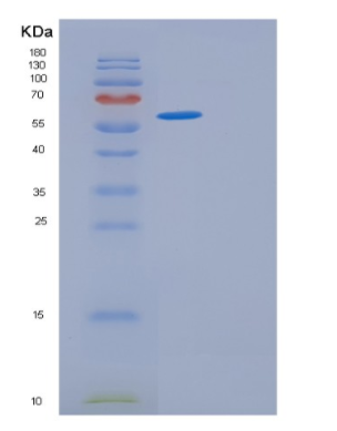 Recombinant Human GPT2 Protein,Recombinant Human GPT2 Protein