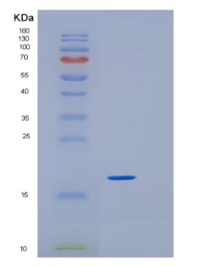 Recombinant Human GREM1 Protein,Recombinant Human GREM1 Protein