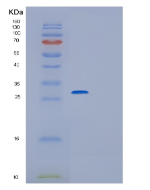 Recombinant Mouse Glutathion S-Transferase Mu1 Protein,Recombinant Mouse Glutathion S-Transferase Mu1 Protein