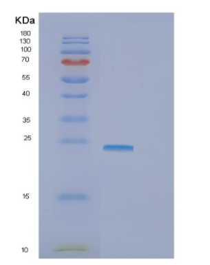 Recombinant Human GNPNAT1 Protein,Recombinant Human GNPNAT1 Protein