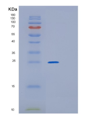 Recombinant Human GPX3(U73C) Protein,Recombinant Human GPX3(U73C) Protein