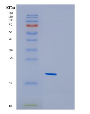 Recombinant Human GREM2 Protein,Recombinant Human GREM2 Protein