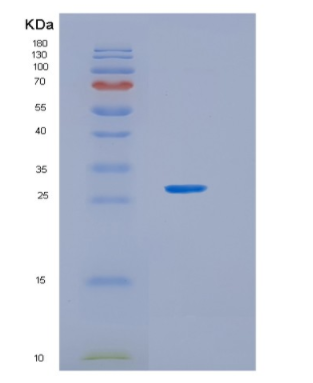 Recombinant Rat Growth hormone receptor Protein,Recombinant Rat Growth hormone receptor Protein