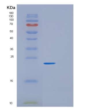 Recombinant Human GRPEL1 Protein,Recombinant Human GRPEL1 Protein