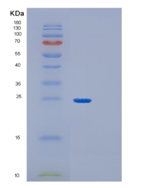 Recombinant Human GPX1 (U49C) Protein,Recombinant Human GPX1 (U49C) Protein