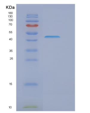 Recombinant Human GORASP2 Protein,Recombinant Human GORASP2 Protein