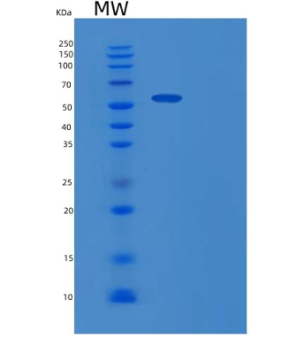 Recombinant Mouse Gpt Protein,Recombinant Mouse Gpt Protein