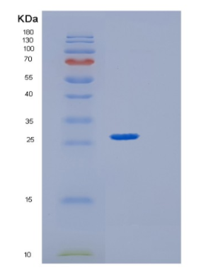 Recombinant Human GRB2 Protein,Recombinant Human GRB2 Protein