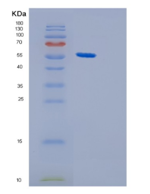 Recombinant E.coli GroEL Protein,Recombinant E.coli GroEL Protein