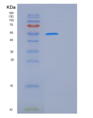 Recombinant Human GSS Protein,Recombinant Human GSS Protein