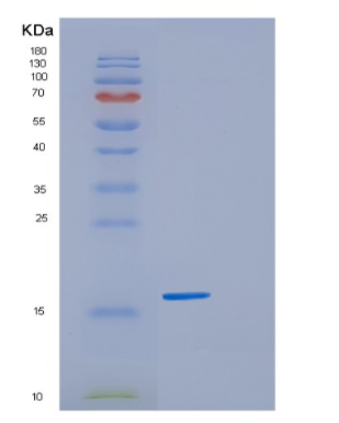 Recombinant Human GSKIP Protein,Recombinant Human GSKIP Protein