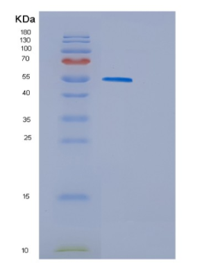 Recombinant Human GSR Protein,Recombinant Human GSR Protein