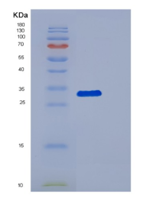 Recombinant Human DCAF7 Protein,Recombinant Human DCAF7 Protein