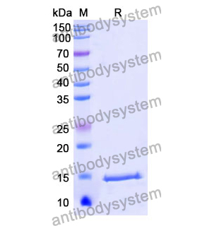 抗 Human C6/Complement C6 纳米抗体 (SAA1039)(RHC99702),Anti-Human C6/Complement C6 Nanobody (SAA1039)