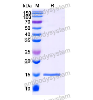 抗 SARS-CoV-2 S Protein 纳米抗体 (SAA1028)(RVV00143),Anti-SARS-CoV-2 S Protein Nanobody (SAA1028)