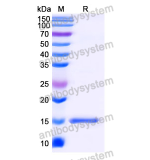 抗 SARS-CoV-2 S Protein 纳米抗体 (SAA0969)(RVV00134),Anti-SARS-CoV-2 S Protein Nanobody (SAA0969)