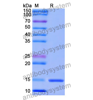 抗 Human GRM5 納米抗體 (SAA1086)(RHE33002),Anti-Human GRM5 Nanobody (SAA1086)