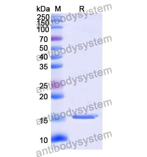 抗 Human AKT1 納米抗體 (SAA1231)(RHD96503),Anti-Human AKT1 Nanobody (SAA1231)