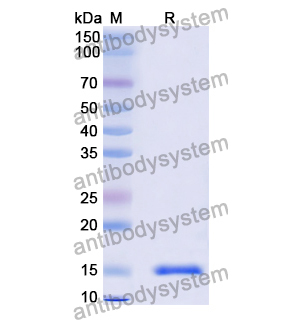 抗 Vibrio cholerae higB-2 納米抗體 (SAA0851)(RXX10102),Anti-Vibrio cholerae higB-2 Nanobody (SAA0851)