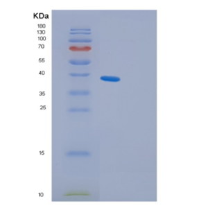 Recombinant Human GIPC1 Protein,Recombinant Human GIPC1 Protein