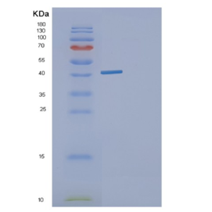 Recombinant E. coligldA Protein,Recombinant E. coligldA Protein