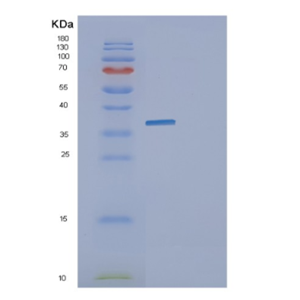 Recombinant E.coli glk Protein