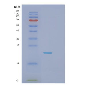 Recombinant Mouse Glo1 Protein,Recombinant Mouse Glo1 Protein