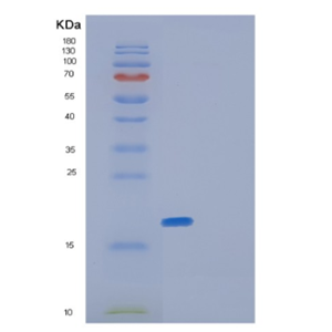 Recombinant Human GLRX5 Protein,Recombinant Human GLRX5 Protein