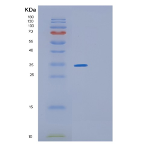 Recombinant E.coli glsA1 Protein,Recombinant E.coli glsA1 Protein