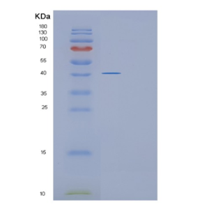 Recombinant Human GLUL Protein