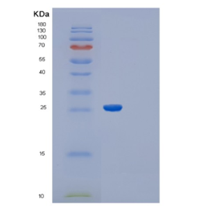 Recombinant Schistosoma japonicum RecombinantGlutathione S-Transferase(GST) Protein