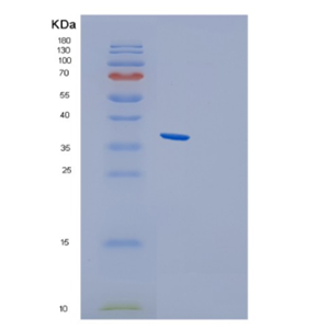 Recombinant Human GLYATL2 Protein