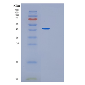 Recombinant Human GMDS Protein