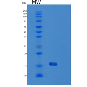 Recombinant Human GMF-γ Protein,Recombinant Human GMF-γ Protein