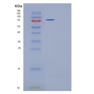 Recombinant Human GMPS Protein,Recombinant Human GMPS Protein