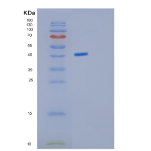 Recombinant Human GNAI3 Protein