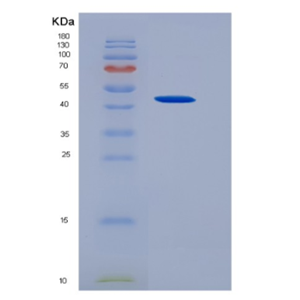 Recombinant Colony Stimulating Factor 2, Granulocyte Macrophage (GM-CSF),Recombinant Colony Stimulating Factor 2, Granulocyte Macrophage (GM-CSF)