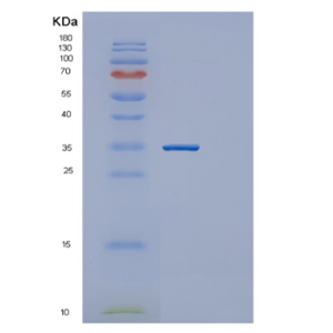 Recombinant Human GNMT Protein,Recombinant Human GNMT Protein