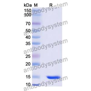 抗 Human CXCL11/I-TAC 納米抗體 (SAA1272)(RHA24601),Anti-Human CXCL11/I-TAC Nanobody (SAA1272)