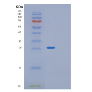 Recombinant Human GLTPD1 Protein