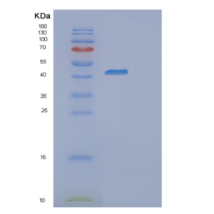 Recombinant Human GNAZ Protein,Recombinant Human GNAZ Protein