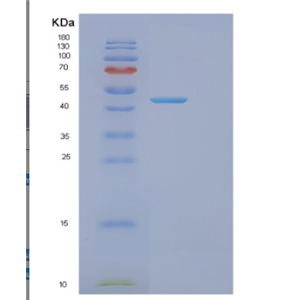 Recombinant Mouse Got1 Protein