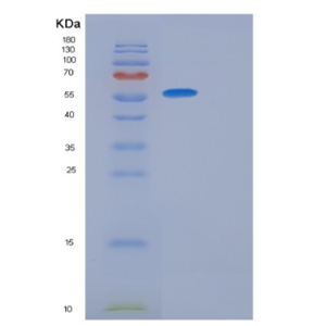 Recombinant Human GPT Protein