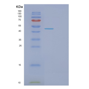 Recombinant Human GLOD4 Protein,Recombinant Human GLOD4 Protein