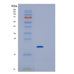 Recombinant Human Glyoxalase I Protein