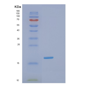 Recombinant Human GOLGA7 Protein