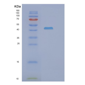 Recombinant Human GOT1 Protein