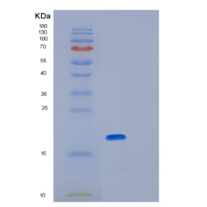 Recombinant Human GPX7 Protein,Recombinant Human GPX7 Protein